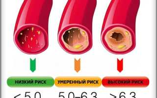 Норма холестерина