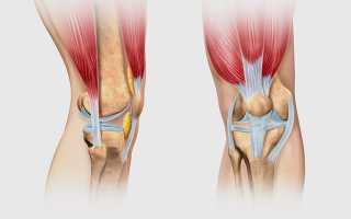 Боли в колене после физической нагрузки