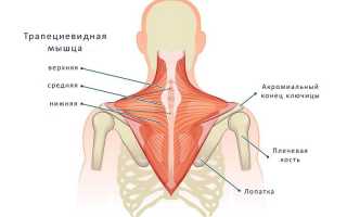 Боль в трапециевидной мышце