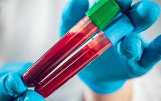 Как называется анализ крови на наличие паразитов?